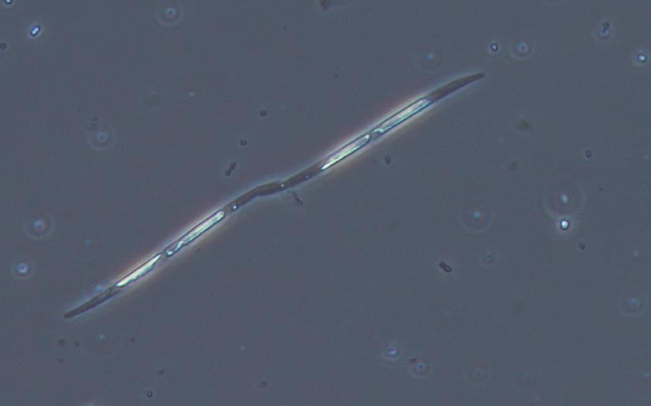 Photographie d'une cellule de phytoplancton