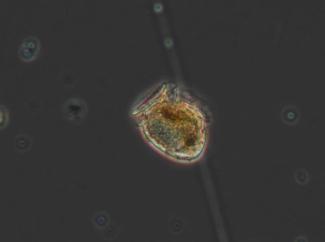 phytoplancton au miscroscope