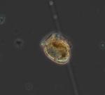 phytoplancton au miscroscope
