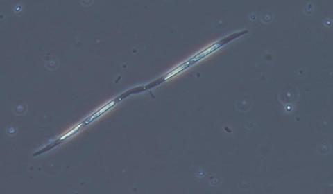 photo de plancton au microscope