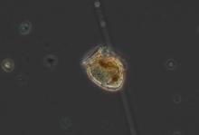 phytoplancton au miscroscope